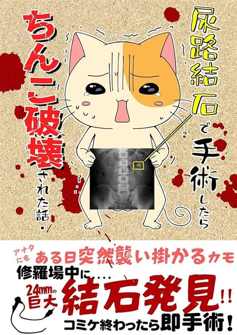 24㎜の結石を手術で取り出した時のレポ漫画も持っていきます 