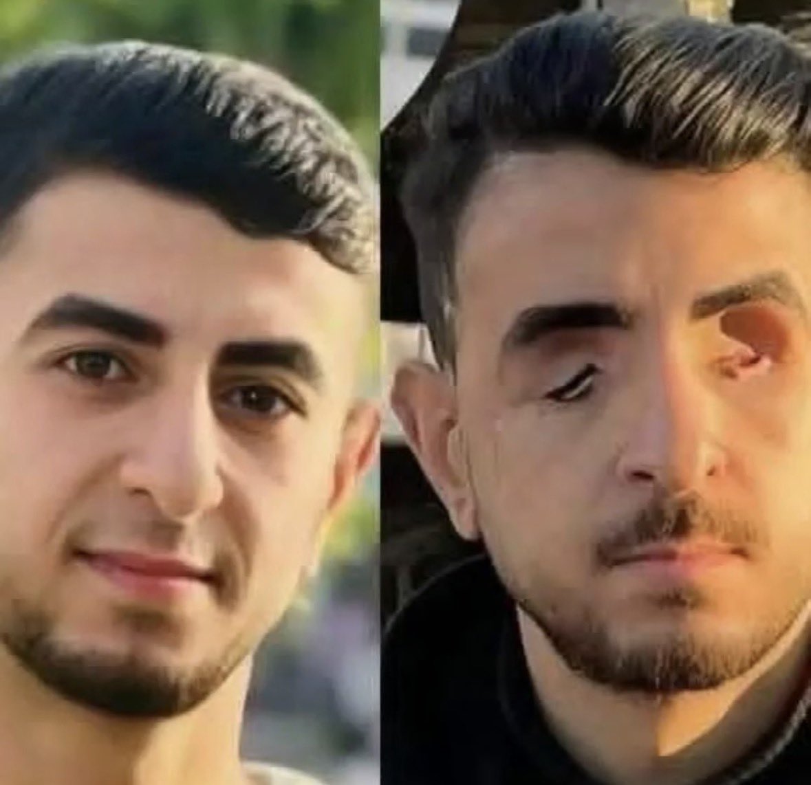 Bunu İsrail yaptı.
 #GazzeyiUnutma