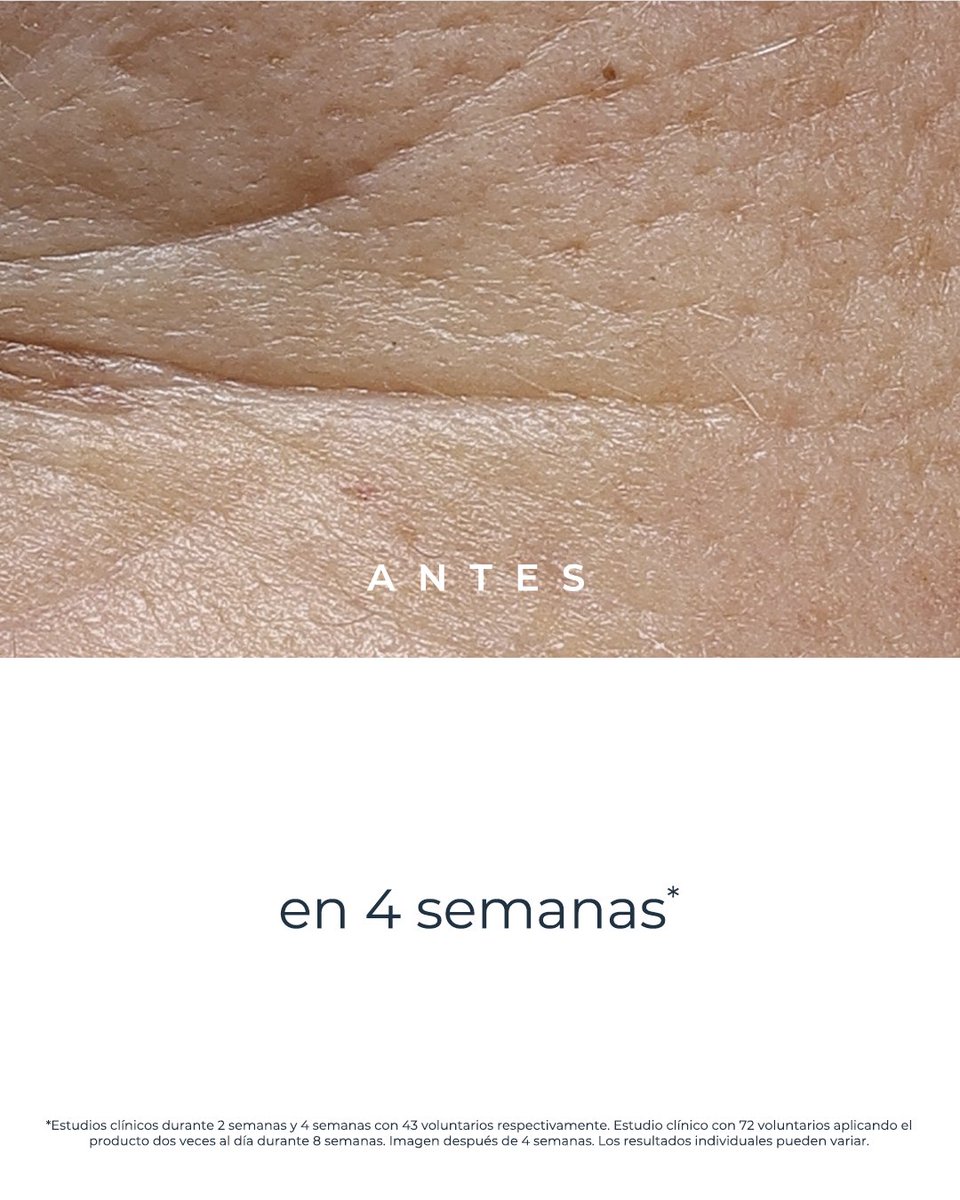 EucerinES's tweet photo. Cómo actúa #EpigeneticSerum sobre la piel. 👇
✔️ Más firmeza
✔️ #Efectolifting
✔️ Menos arrugas
✔️ Contornos definidos
✔️ Hidratación y luminosidad
✔️ Piel uniforme, suave y rejuvenecida
#epigenetica #antiedad https://t.co/z6VIfhVdmX
