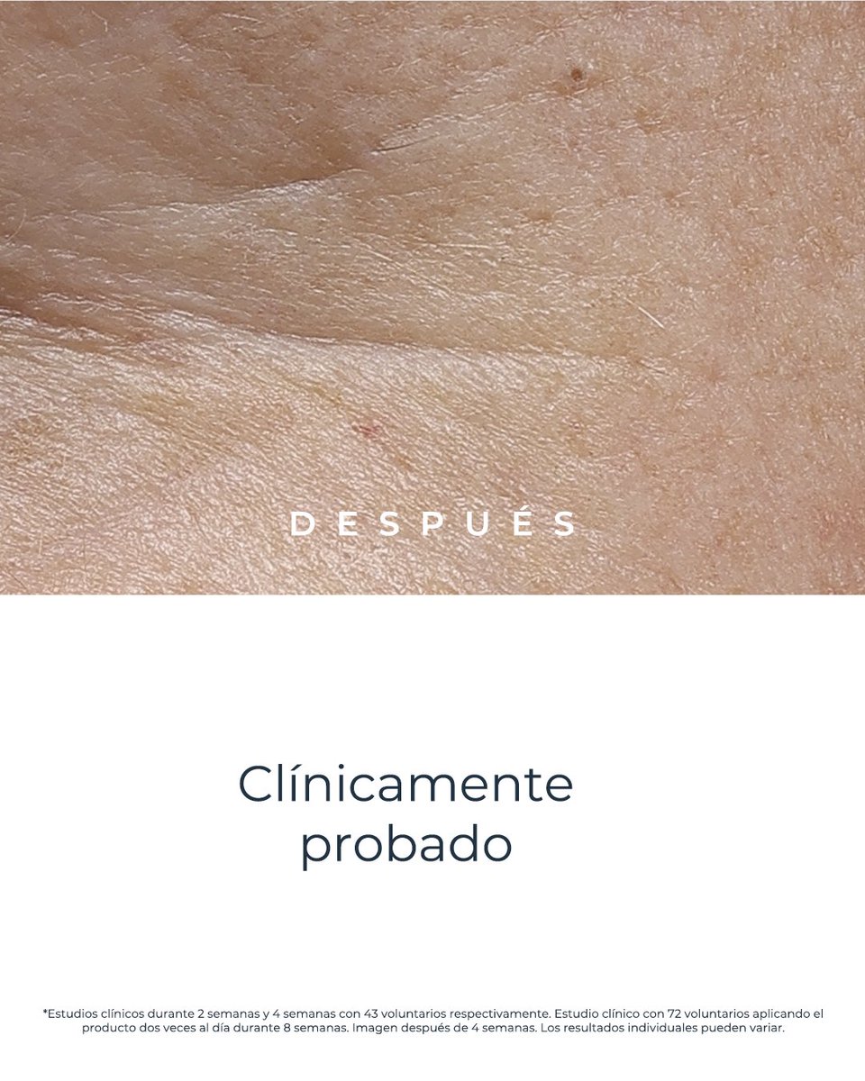 EucerinES's tweet photo. Cómo actúa #EpigeneticSerum sobre la piel. 👇
✔️ Más firmeza
✔️ #Efectolifting
✔️ Menos arrugas
✔️ Contornos definidos
✔️ Hidratación y luminosidad
✔️ Piel uniforme, suave y rejuvenecida
#epigenetica #antiedad https://t.co/z6VIfhVdmX