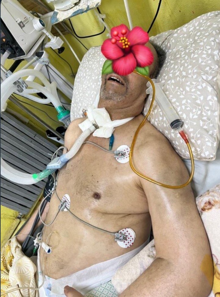 YassineTwts's tweet image. 🚨IMPORTANT LISEZ🚨

Nous avons besoin de votre aide pour sauver le père d’un ami proche, Yacine Zaaboub, qui se bat pour sa vie en Algérie.

À la suite de trois AVC, il est aujourd’hui cloué dans un fauteuil roulant, très affaibli. Les médecins ont récemment dû le débrancher des…