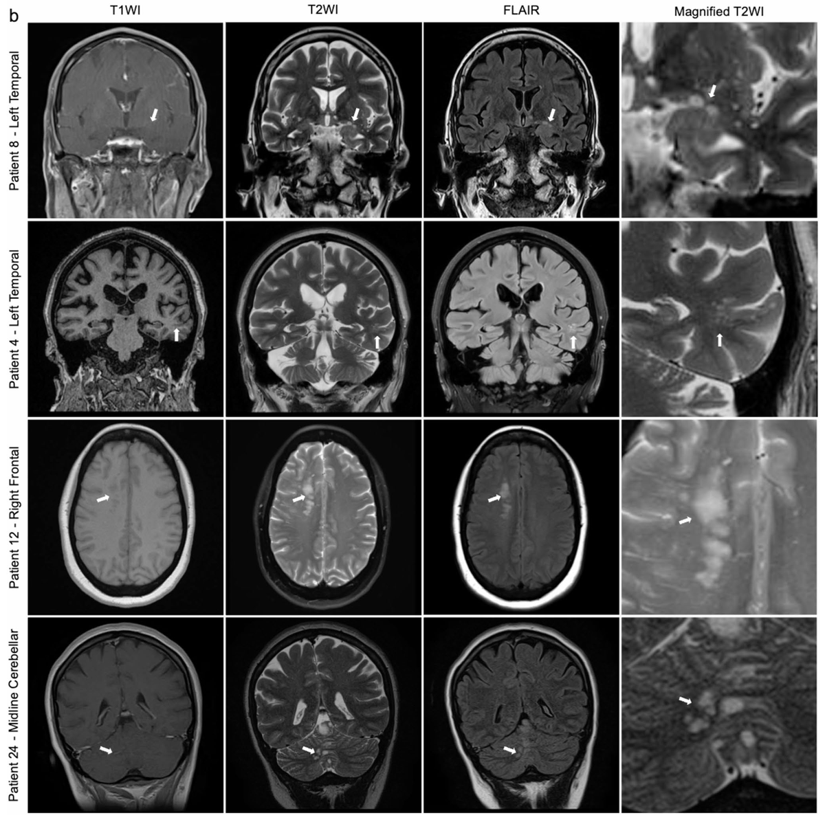 Dhairya A. Lakhani, MD tweet media