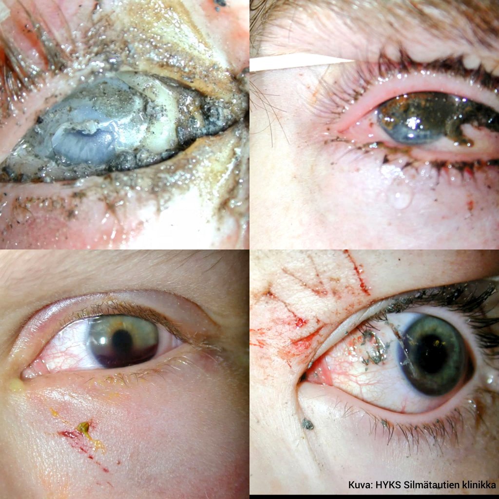 Taisto Hakala tweet media