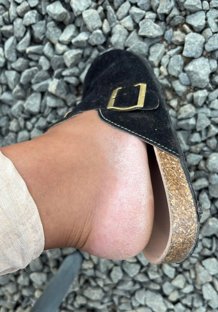 Kgadi_yaMoloto's tweet image. How can one fix this problem?😭😭😭