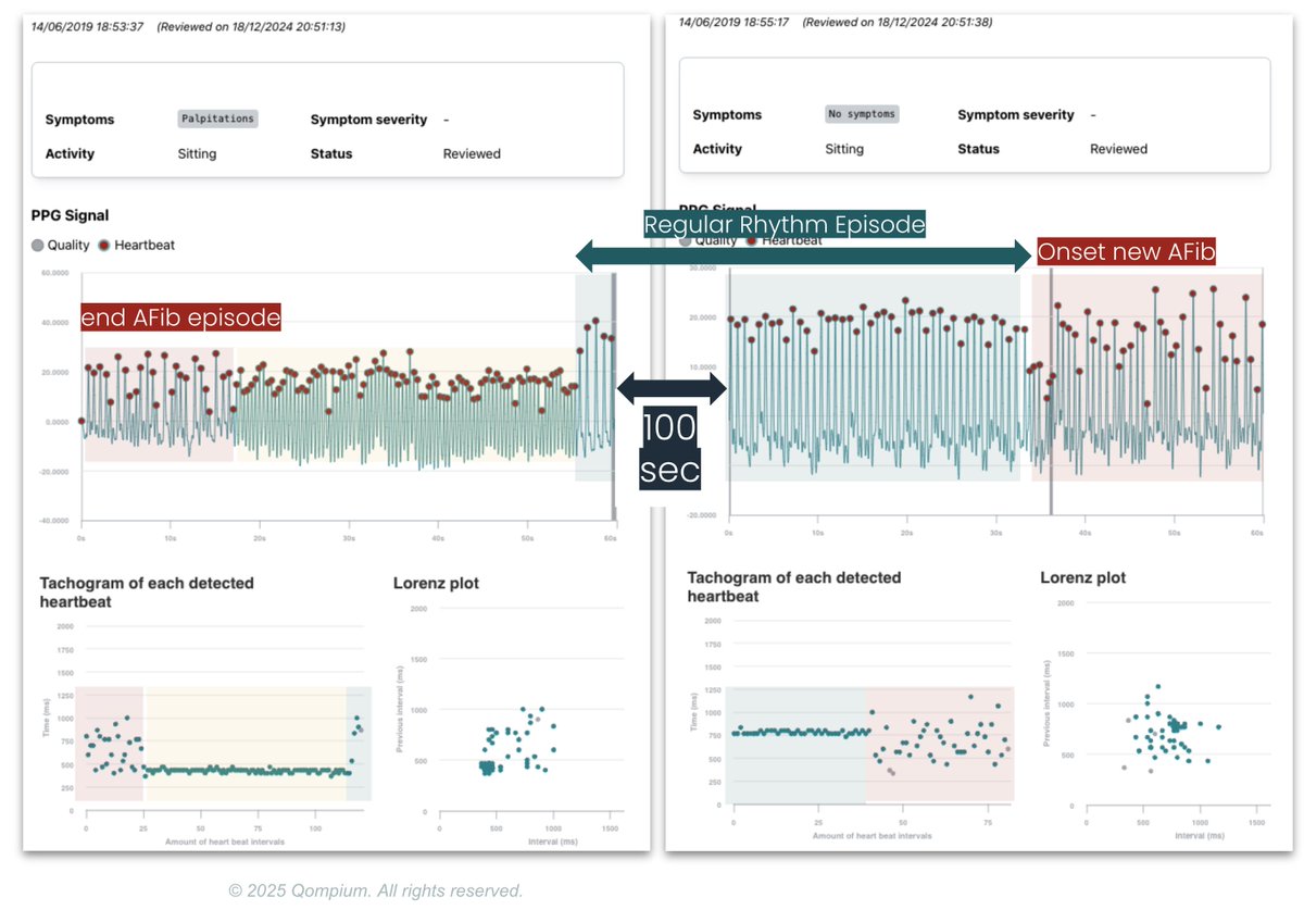 FibriCheck tweet media