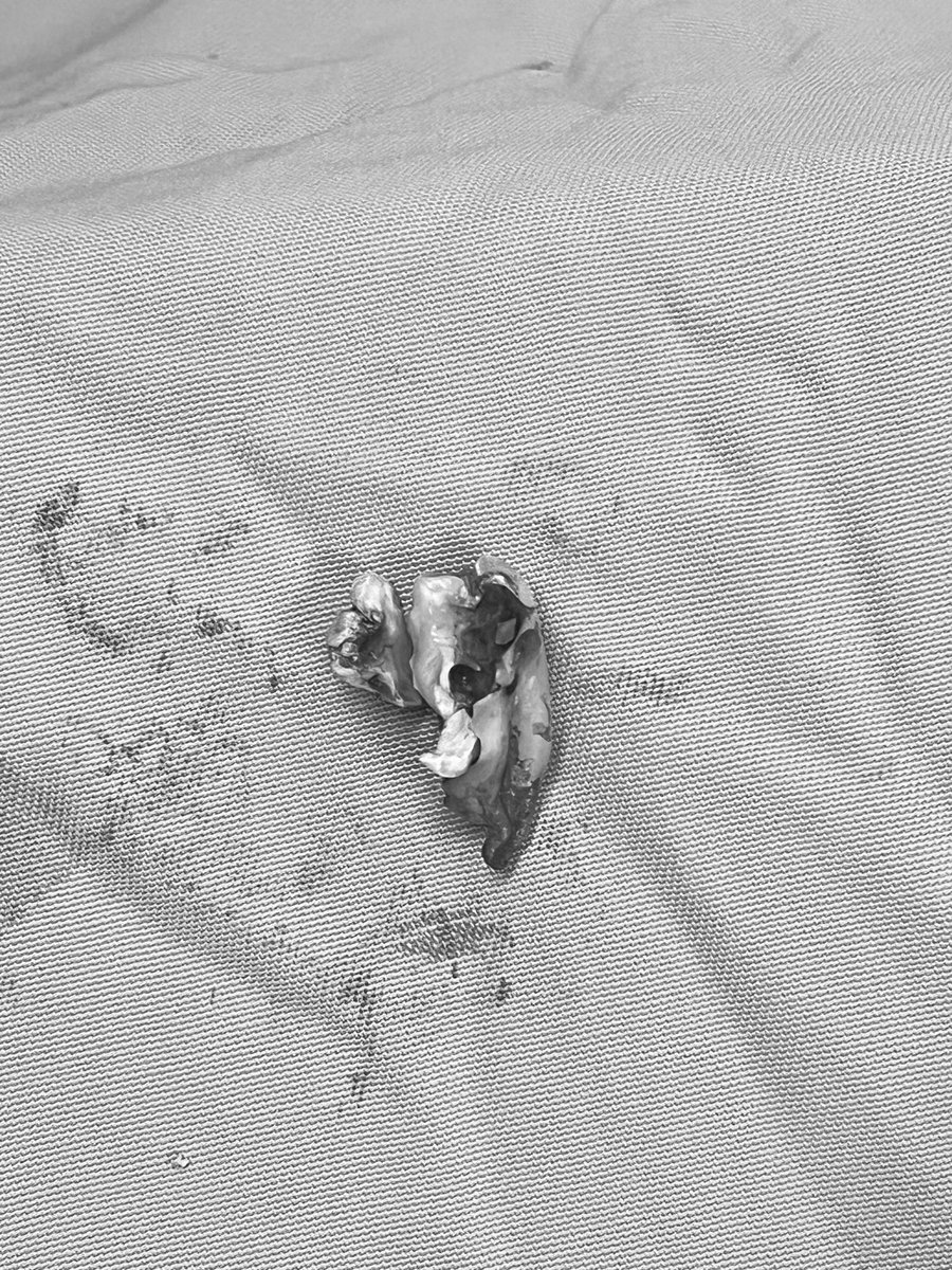 triharaan's tweet photo. hiii update cerita koas annis!! i have my first minor surgery OD🥹🫶🏻 https://t.co/4P10PxZKsc