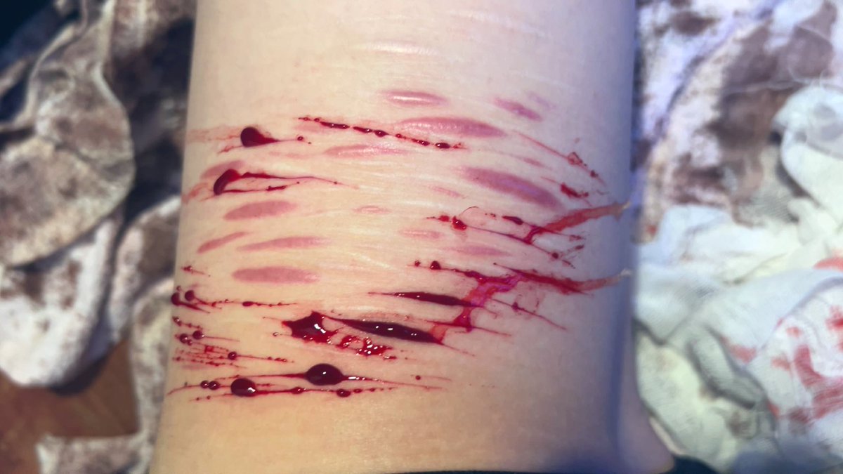 TightRazor's tweet photo. Self harm shit cut need kai razor https://t.co/9PIMJd3C6i