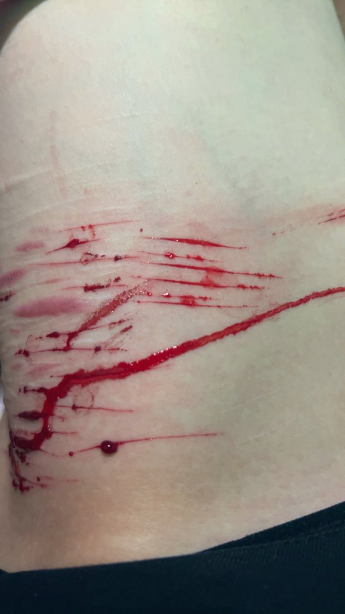 TightRazor's tweet photo. Self harm shit cut need kai razor https://t.co/9PIMJd3C6i
