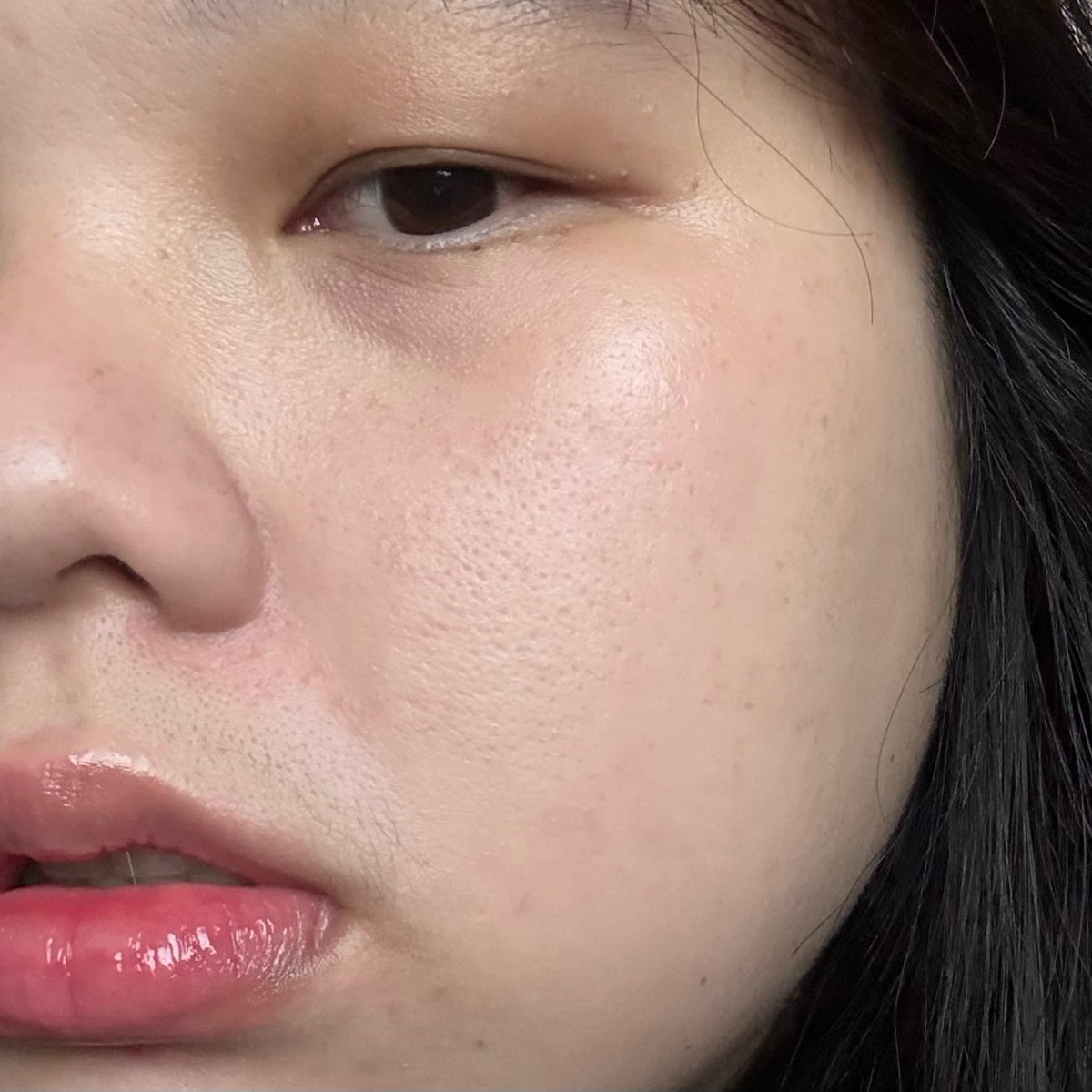 ยกให้เป็นมอยส์ B5 แห่งปี ♡ มอยส์ปลอบผิวดีจริง ช่วงผิวแดง คัน ลอก คือต้องหยิบมาโบกทุกครั้ง มอยส์ซ่อมผิวพัง Dermie โบกติดกันไปเลย 7 วัน ผิวเนียนขึ้นมาก ขึ้นแท่นมอยส์ลูกรักช่วงปลายปีไปแล้ว ที่สำคัญ เป็นมอยส์ B5 ที่เนื้อโคตรดี เกลี่ยง่าย สบายผิวซึมไว แบบสูตรเทียบแบรนด์ดังได้เลย