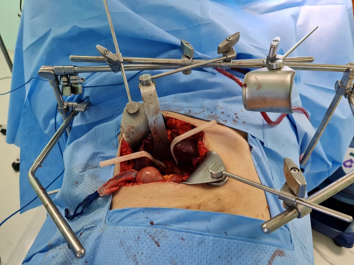 Thompson Retractor tweet media