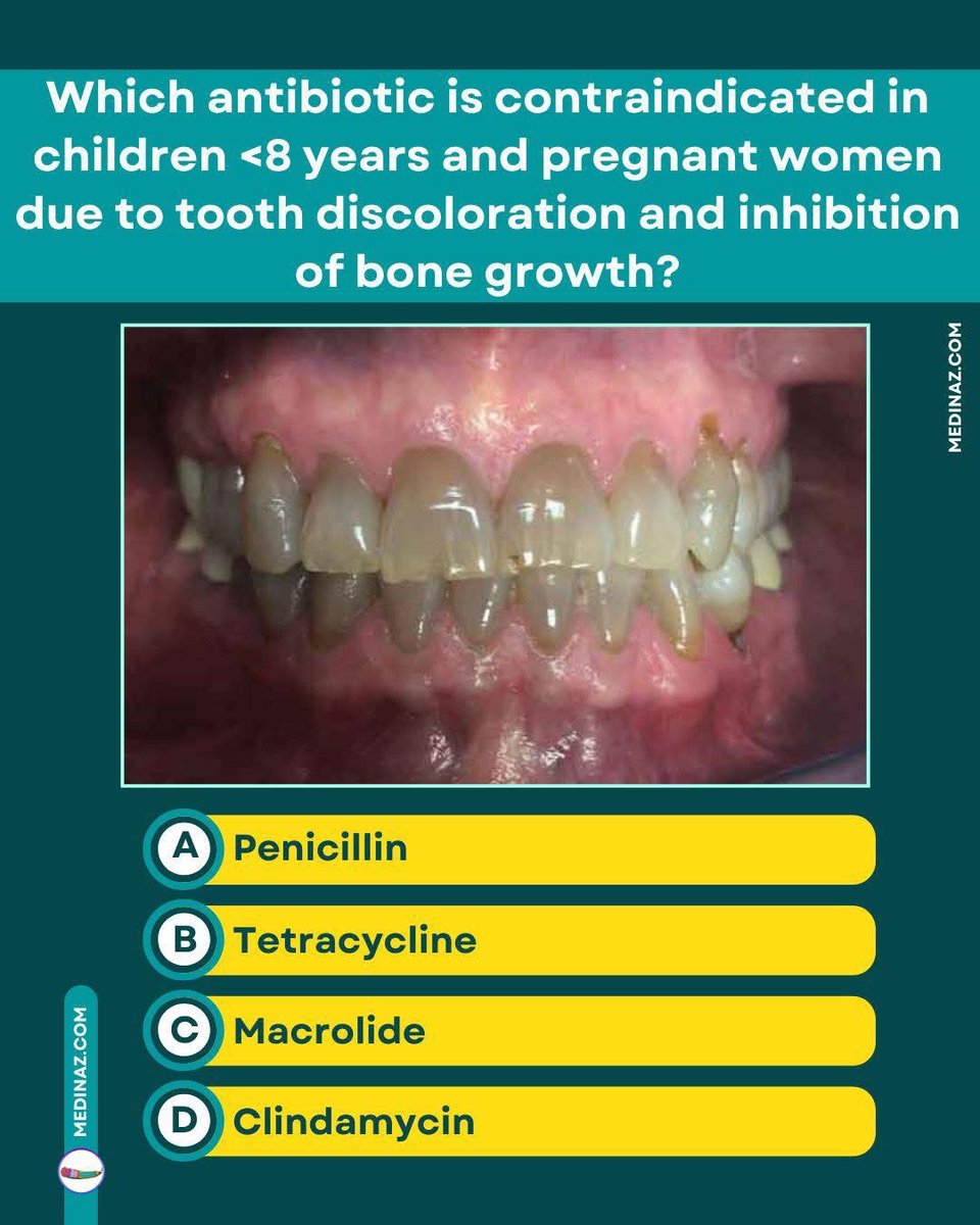 Doctors__squad's tweet photo. Which antibiotic is contraindicated in children <8 years and pregnant women due to tooth discoloration and inhibition of bone growth? https://t.co/2vgi9xX4gk