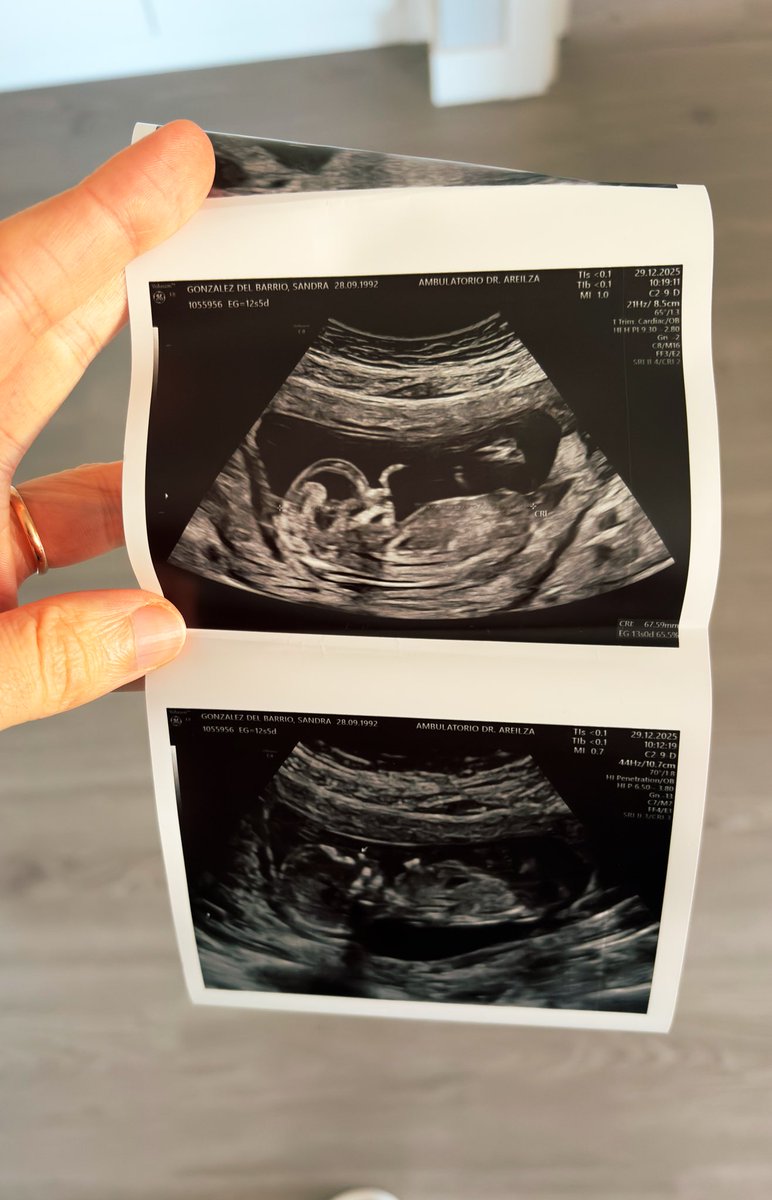 𝘈𝘪𝘮𝘢𝘳 ✈︎ tweet media