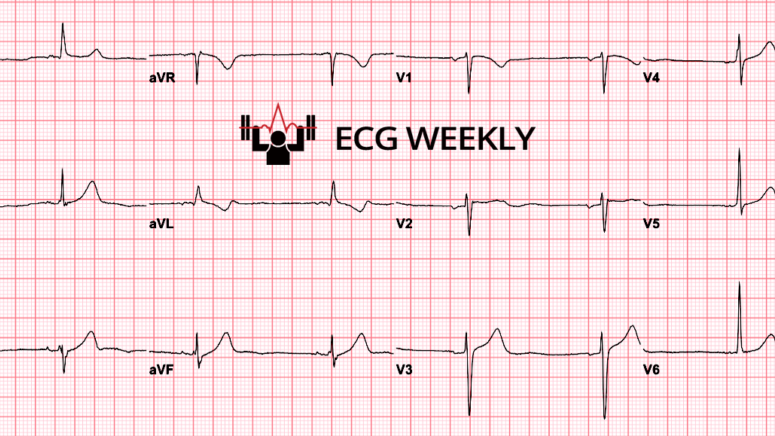 ECGWeekly tweet media