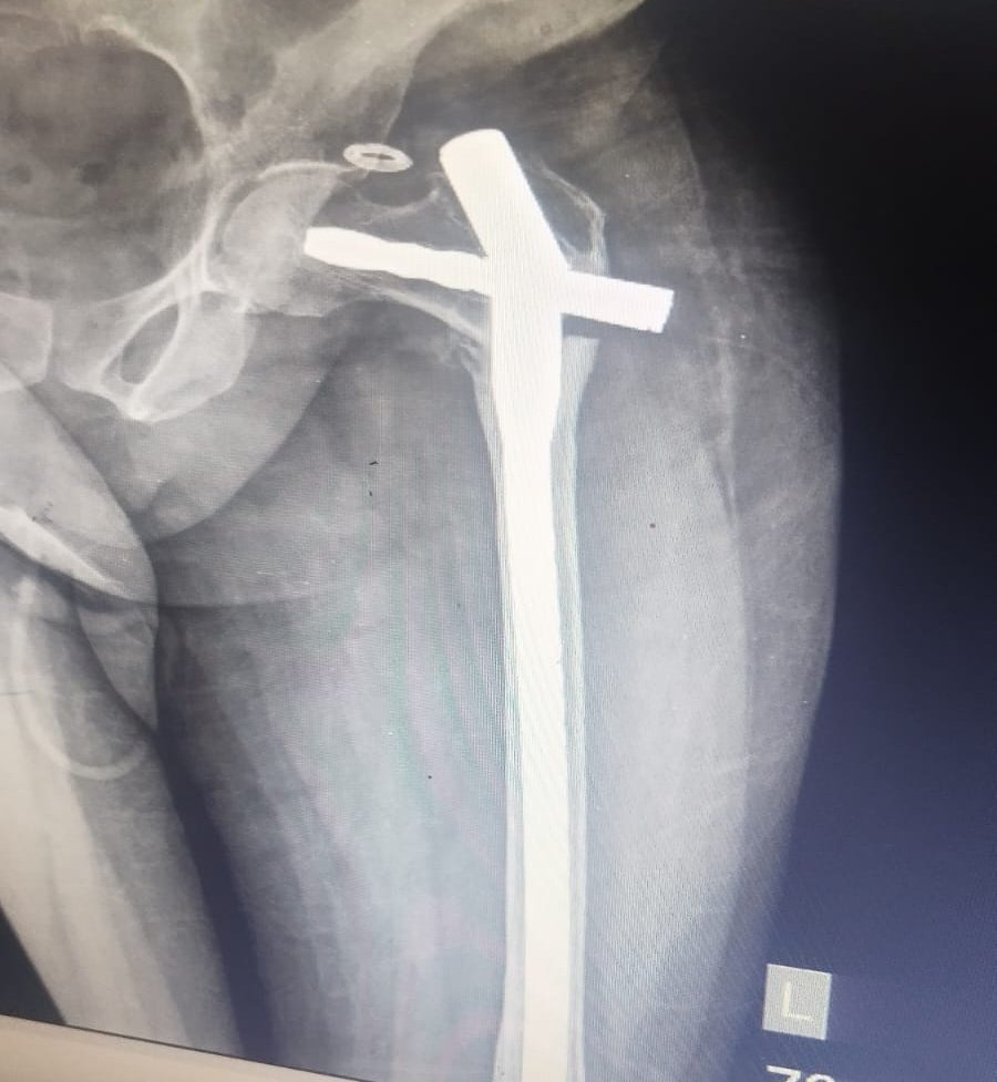 Orthopod tweet media