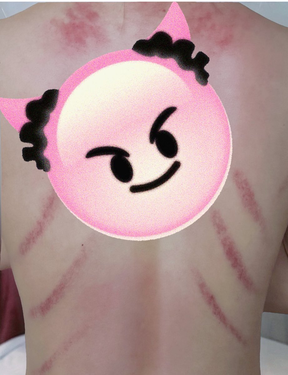 吃完饭下楼做了个精油开背
推拿师：这是活血
我照镜子一看：这是活着的证据！

建议下次别叫精油开背
叫“满清十八道酷刑·都市养生版”😭