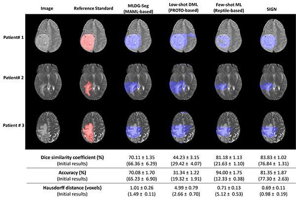 Radiology: Artificial Intelligence tweet media
