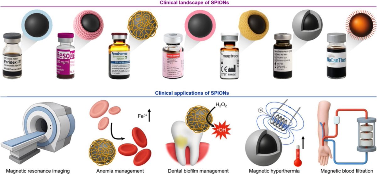 ADDReditors's tweet photo. ADDR Open Access: Clinical translation and landscape of superparamagnetic iron oxide nanoparticles.
By Roger M. Pallares &amp; coworkers @RWTH   @CRS_DeChAt_LC
#IronOxide #nanoparticle #imaging #theranostic
https://t.co/ukgIZkNkKE https://t.co/QATwyZmQmy