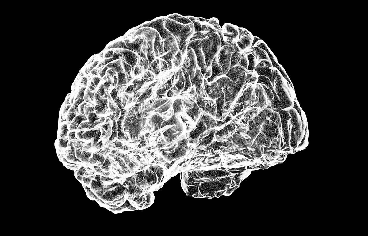 mecfsskeptic's tweet image. 1) This year, there were reports of 7 autopsies of ME/CFS patients, showing a dramatic reduction in CRH-producing neurons. This info was shared at the IACFS/ME conference, but the results still haven’t been published yet.

Similar findings have been found in type 1 narcolepsy.