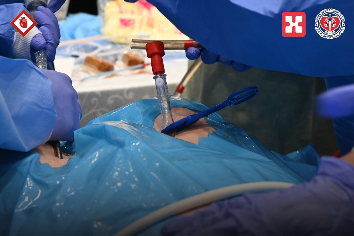 ECMOlogy tweet media