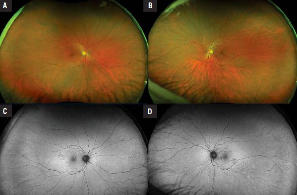 Retina Specialist tweet media