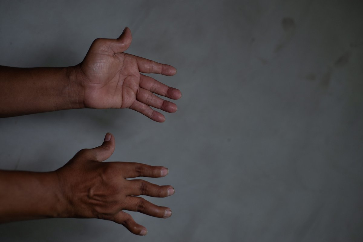 MalaYerba tweet media