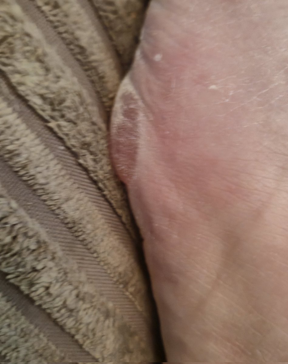 Mat Anderson 🤍💙 tweet media