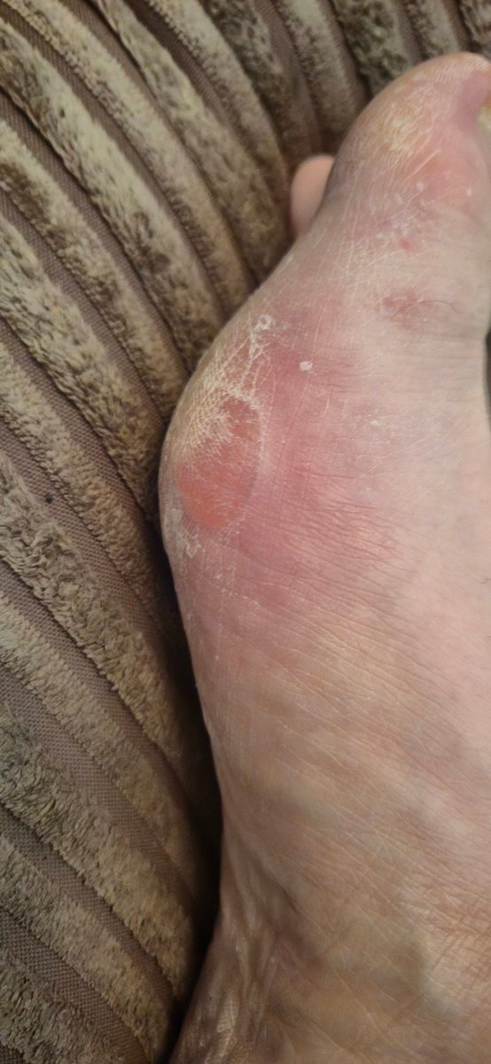 Mat Anderson 🤍💙 tweet media