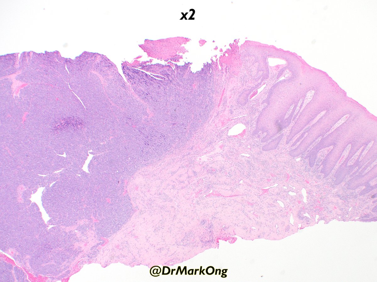 Mark Ong tweet media