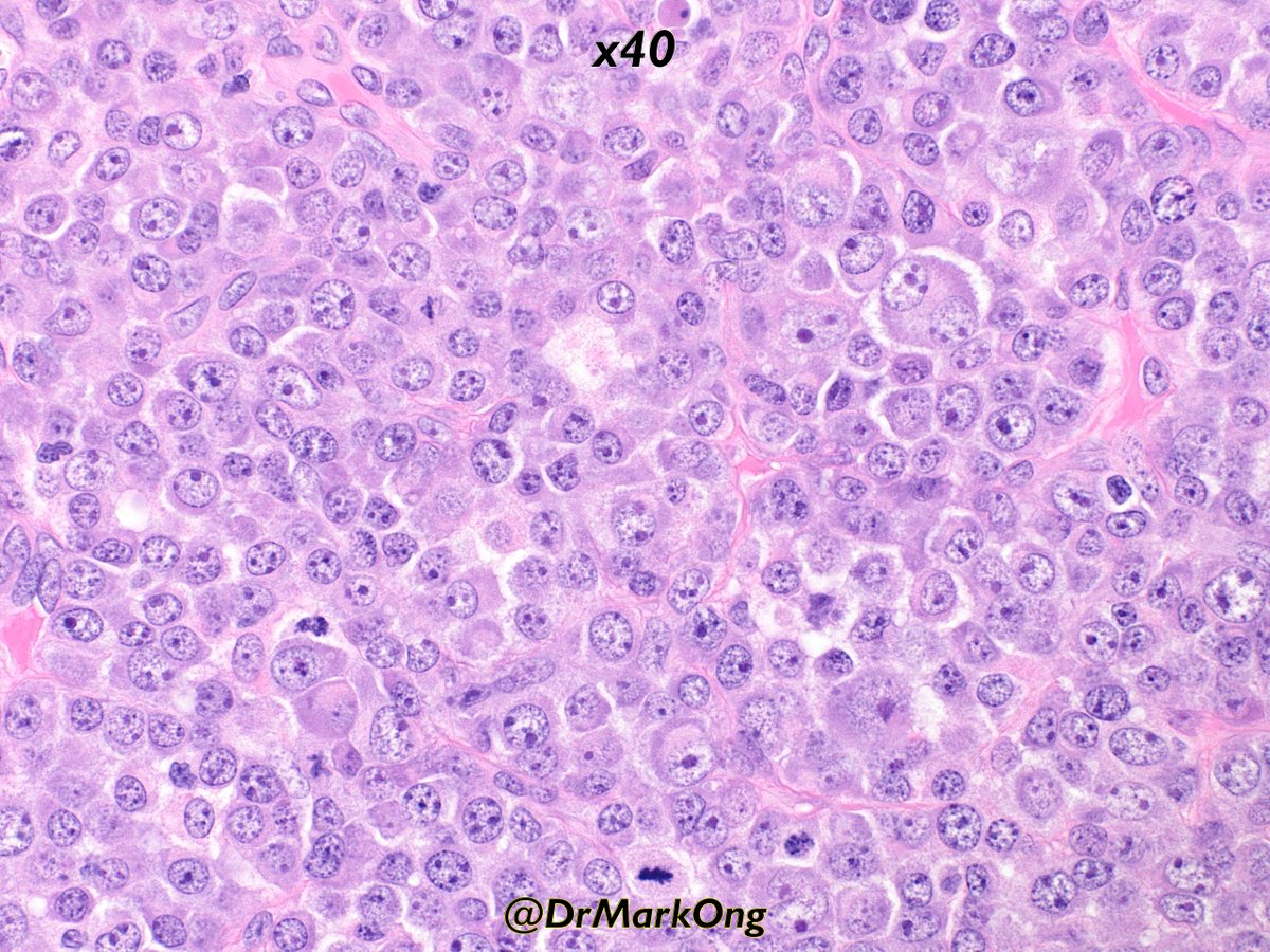 Mark Ong tweet media