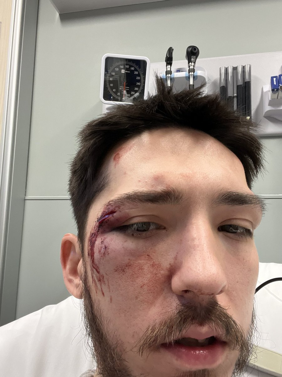 ItsAtizzity's tweet image. someone hitmarkered the quad head on me .