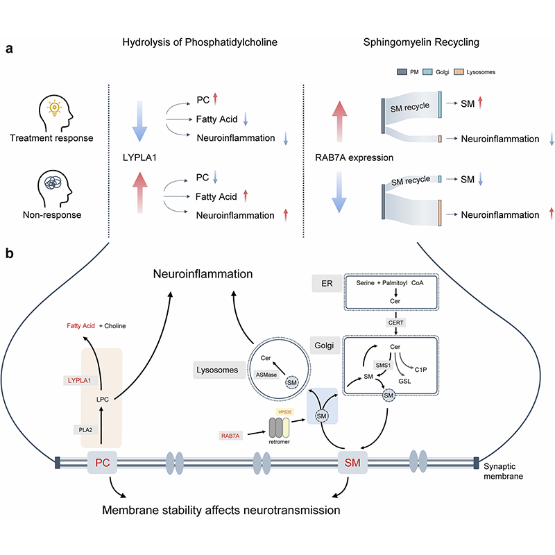sigtrans_sttt's tweet image. #Multiomics profiling of 208 #schizophrenia patients identified proteins, metabolites, and genetic loci predictive of #Paliperidone efficacy, with higher #phosphatidylcholine and #sphingomyelin levels correlating with better response. @PKU1898

#STTT: doi.org/10.1038/s41392…