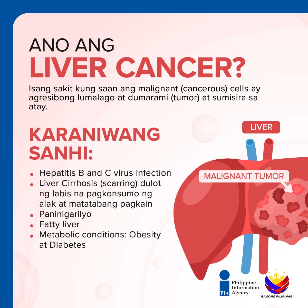 PIADesk's tweet image. Ngayong Liver Cancer and Viral Hepatitis Awareness and Prevention Month, alagaan at pahalagahan natin ang ating atay. Narito ang ilang mahahalagang kaalaman at paalala para sa mas malusog na pamumuhay.

#LiverCare #GetVaccinated #DOH #PIA #BagongPilipinas #IntegratedStateMedia