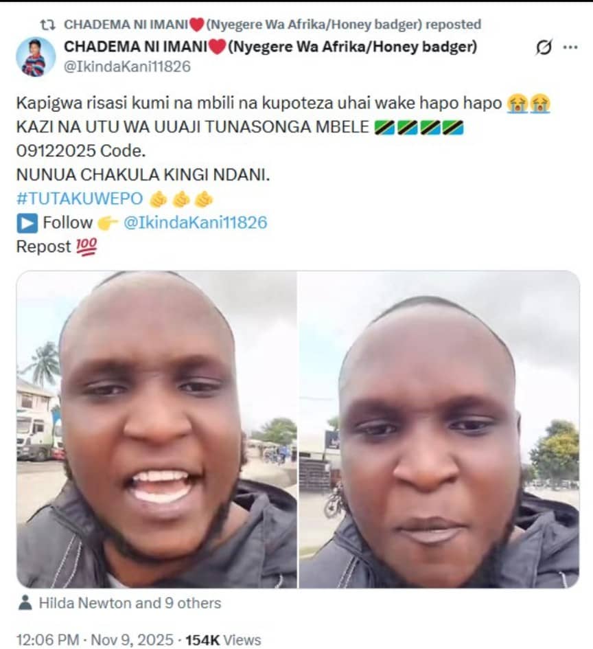 phee_makucha's tweet photo. @MsigwaMpenda Kuliko huyu aliepigwa risasi12 akafa? https://t.co/EPFSC345Gh