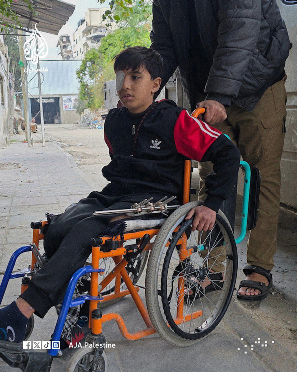The child Mohammed Abu Mohsen is the sole survivor of his family. He is struggling under harsh conditions after losing an eye and suffering fractures, while his parents and siblings were killed in an Israeli bombardment of the Sabra neighborhood in Gaza.