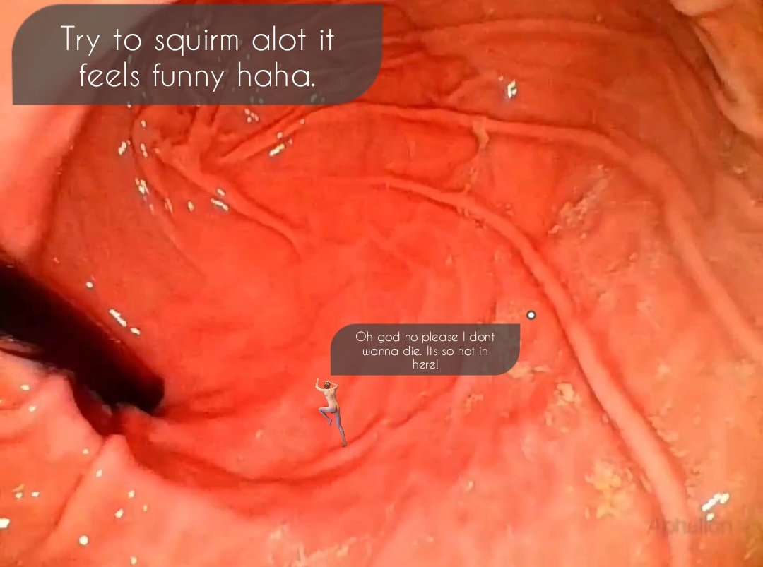 Timdejong179's tweet image. A journey through @GiantessKayla Part 3/6

You had slid down Kayla's throat into her stomach. Luckily for you it was still empty so you still had time to climb out, you thought. This ofcourse was impossible cause food is supposed to stay in there.

#Sizetwitter #Vore #Giantess