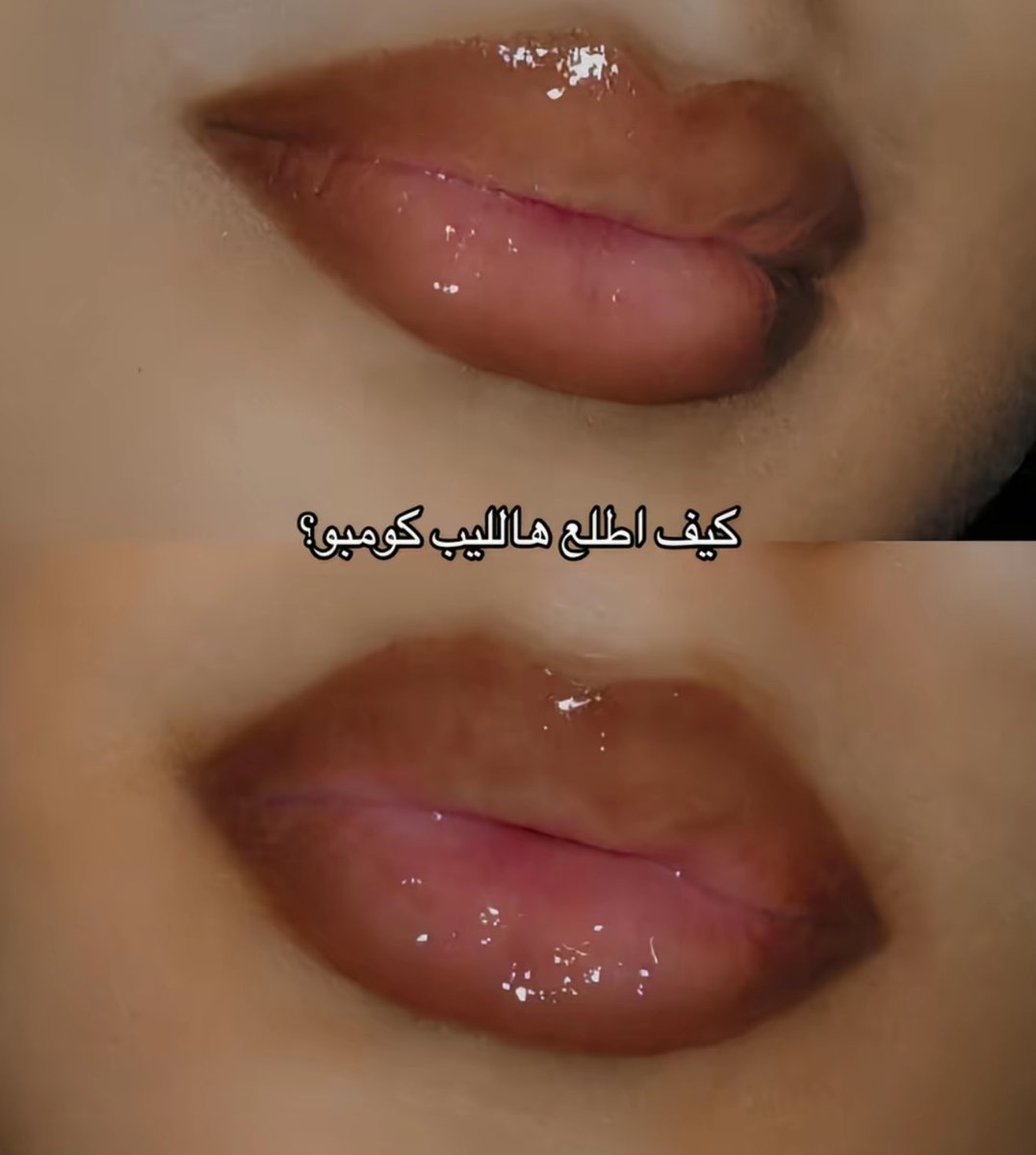 الليب كومبو اللي وين ما اروح  أنسال عنه: