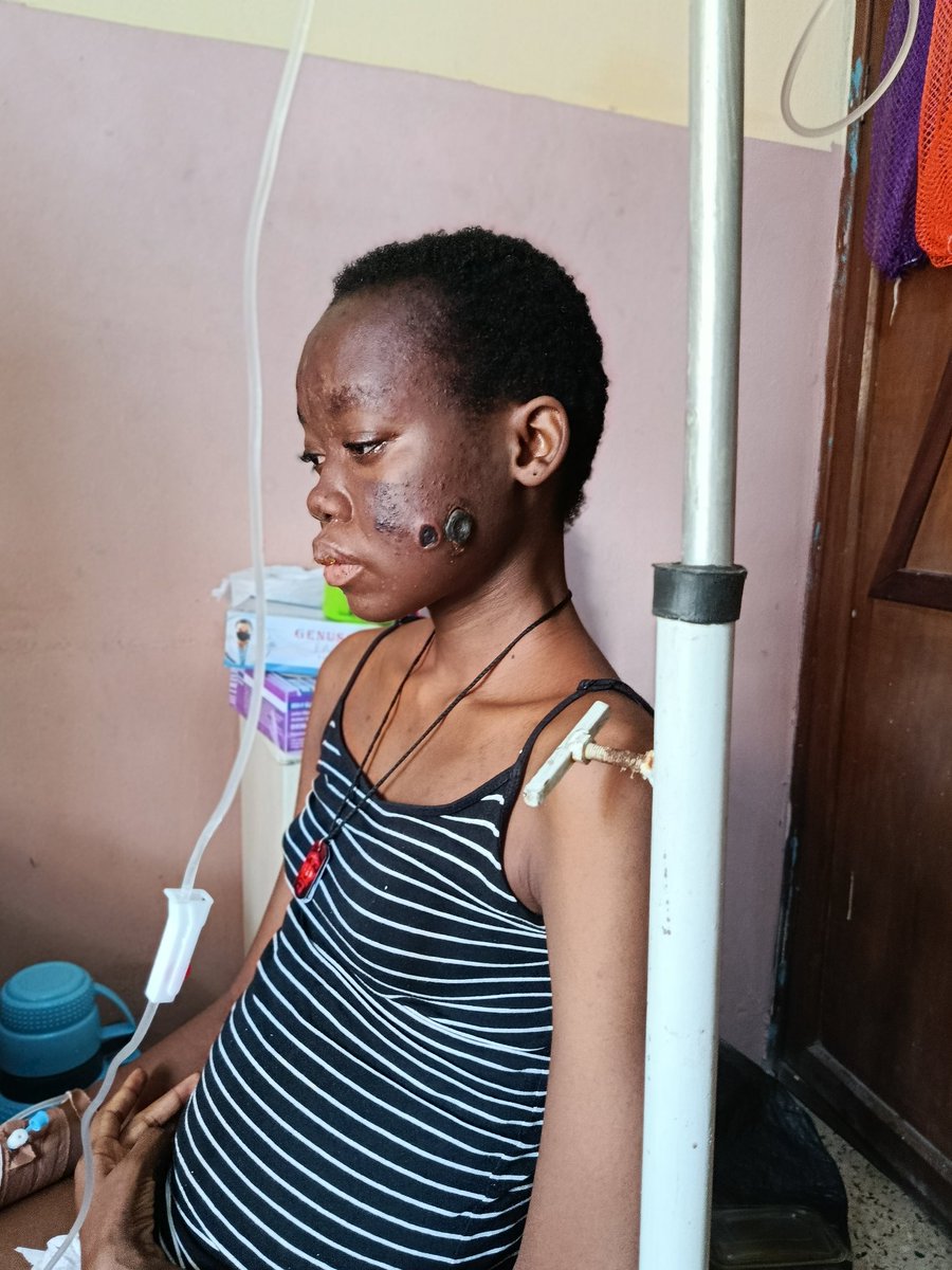 It has been 33 days of asking the world to help save Marycynthia's life. 

A girl who wanted nothing but to live a simple life, go to school, live her dreams and become something. But now... this is definitely not what she imagined. 

Yet, she still chooses hope, believing
