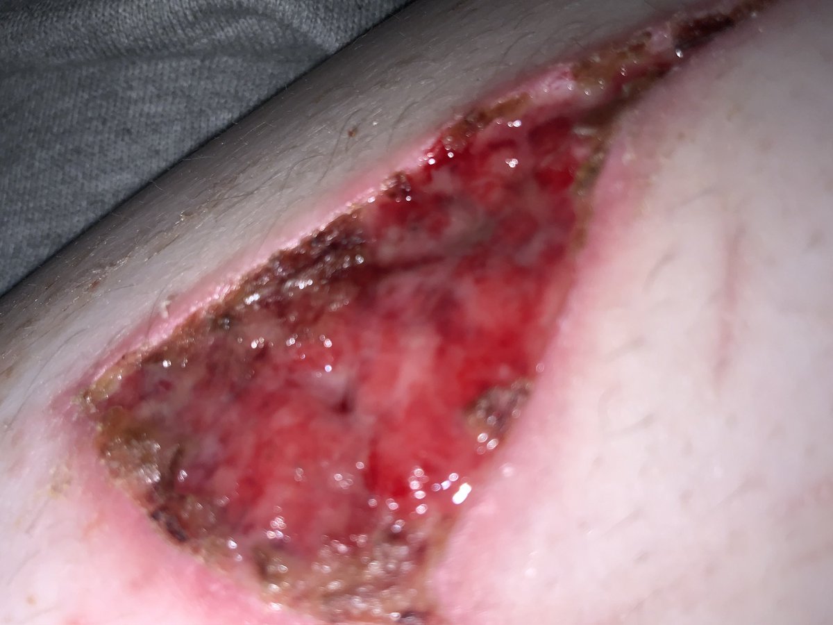 lui shtwt (@lui0497) on Twitter photo 