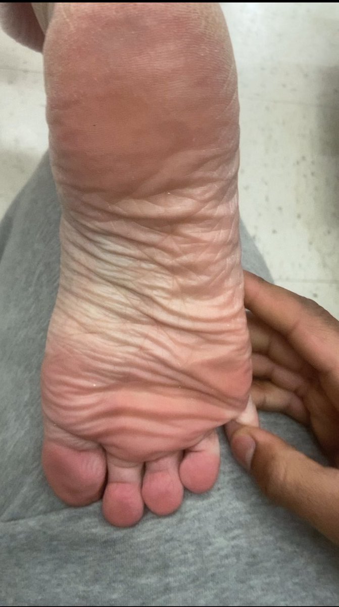 !!Feetfanatic!! tweet media