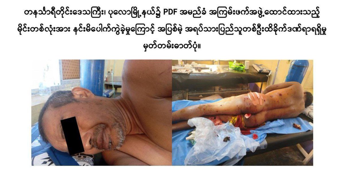 UAung1262022's tweet photo. Because of the inhumane acts of #terrorists, within just two days there were eight incidents in which civilians, including children, were killed or injured. #Pinlaung
#Nganzon #Chauk #Pulaw #WhatsHappeningInMyanmar
#MyanmarFactCheck https://t.co/AnSjkqiDDO