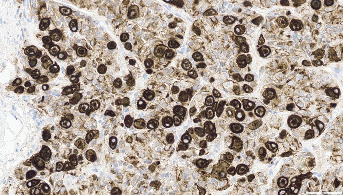 Craig Horbinski tweet media