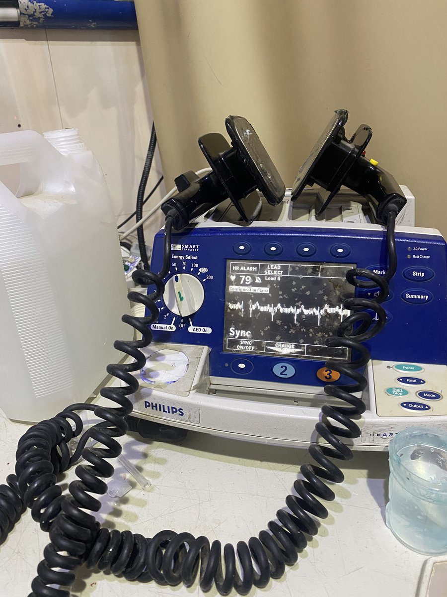 NaderEldefrawy's tweet photo. في تمام الساعة الثانية عشر ليلا 
رسم القلب SVT 
Unrecorded pulse 
اديتها صدمة كهربية ورجعت
Synchronized DC Shock
اللهم أدم هذه اللحظات السعيدة دوما 🥺 https://t.co/jMGvoFamb1
