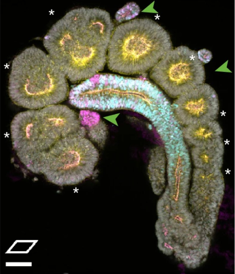 stemcellpodcast's tweet image. Drs. @Komal_Makwana4, Louise Tilley, and Naomi Moris's (@nmoris) lab developed human trunk-like structures to model somite and #neural tube co-development.

🔖 @NatureCellBio - go.nature.com/4qsAmUd
🎙️ - bit.ly/4pOTLib