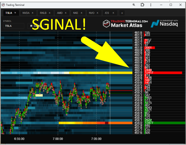 BearBullTraders's tweet photo. Everyone keeps asking, “What happens to day trading with algos and AI?”

Here’s my honest answer, trading has always been against algorithms. Wall Street was algorithmic long before ChatGPT.

Day trading is a pattern recognition game.

Just like a video game, you are playing against machines designed to beat you. Your job is simple, recognize the pattern, press the right key, at the right time.

That’s it.

AI and algos do not kill traders. They add liquidity, speed, and volatility, which is exactly where opportunity lives.

The edge humans have is adaptation.
Markets change, we change. Pandemic trading did not exist, we adapted and built new strategies that worked.

Our brain is the most powerful cognitive system ever created. If the market evolves, we evolve faster.

That’s why I’m not afraid of AI algo trading. I’m excited for it.

And we prove it every single day, live, with price action, market structure, and tools built for pattern recognition.

Day trading is not dying. It’s evolving, and the best traders evolve with it.