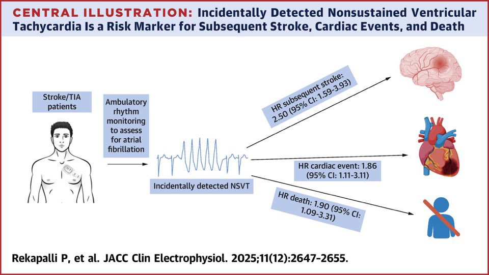 BartoszHudzik's tweet photo. 22% of post-#stroke/#TIA pts had #NSVT on ~19d of monitoring. NSVT linked to 2️⃣-3️⃣× ⬆️ risk of recurrent stroke, #MACE  &amp; #mortality independent of other risk factors 👉 https://t.co/jBoofeF92j #CardioTwitter #NeuroTwitter @JACCJournals @drjohnm @DrMarthaGulati @mmamas1973 https://t.co/6sBP3vDf38