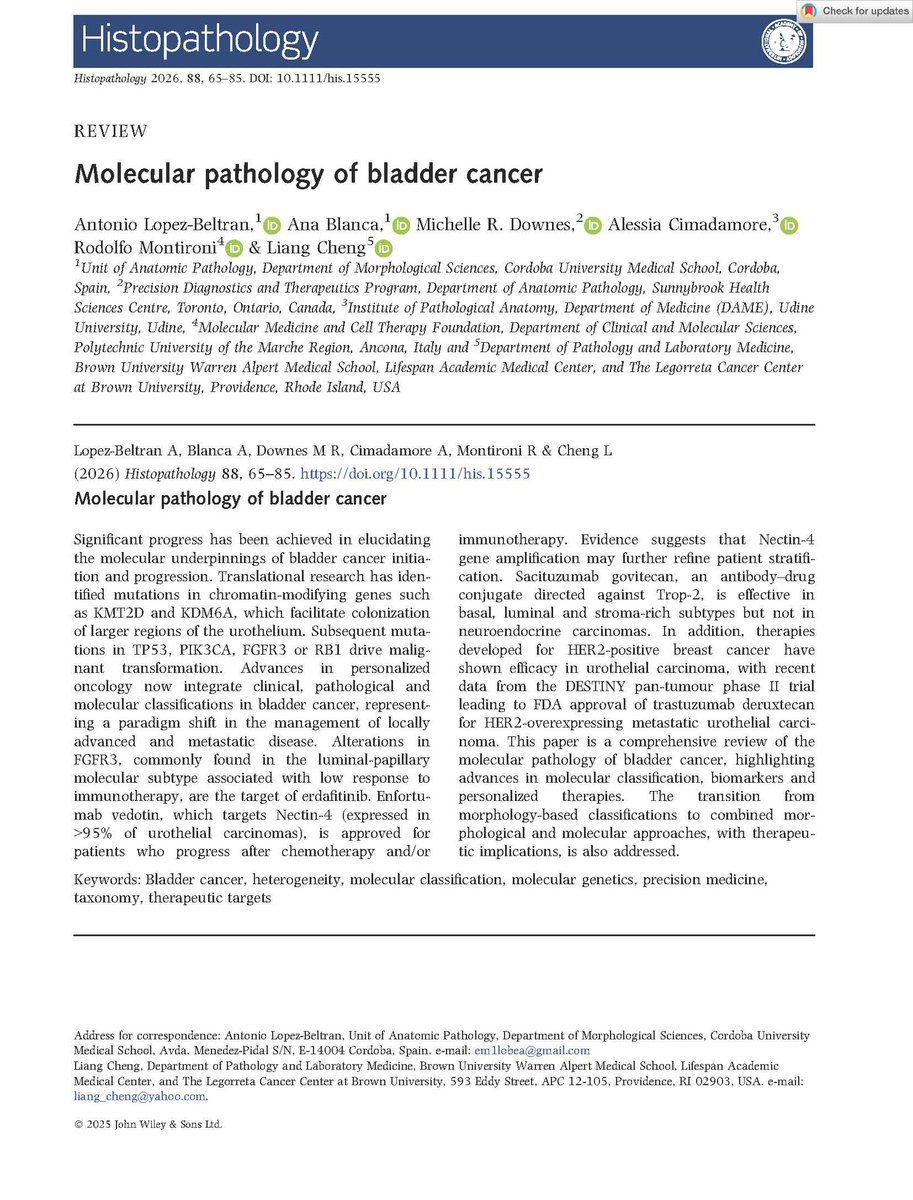 LiangChengMD's tweet image. Need an update on the molecular pathology of bladder cancer? I am delighted to share a comprehensive review article by Dr. Antonio Lopez-Beltran and colleagues, published in the 2026 Annual Review Issue of Histopathology @Histo_Journal @daniel_berney
🔗 Article:…
