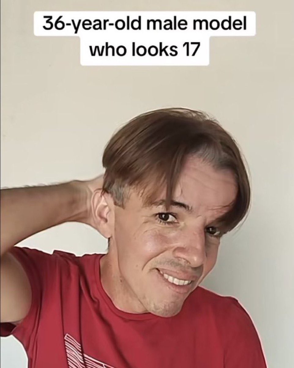 EpichitoMet's tweet image. cada vez que Dross habla del como se ve se siente así