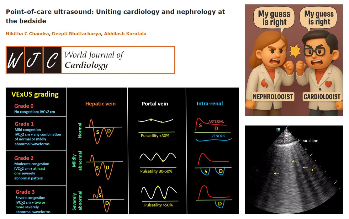 Grateful to be part of this work on #POCUS bringing cardiology and nephrology together at the bedside. #Nephpearls  
The first author is a current IM residency #Match2026 applicant and has been a pleasure to work with -thoughtful, hardworking, and dependable throughout.  
Program