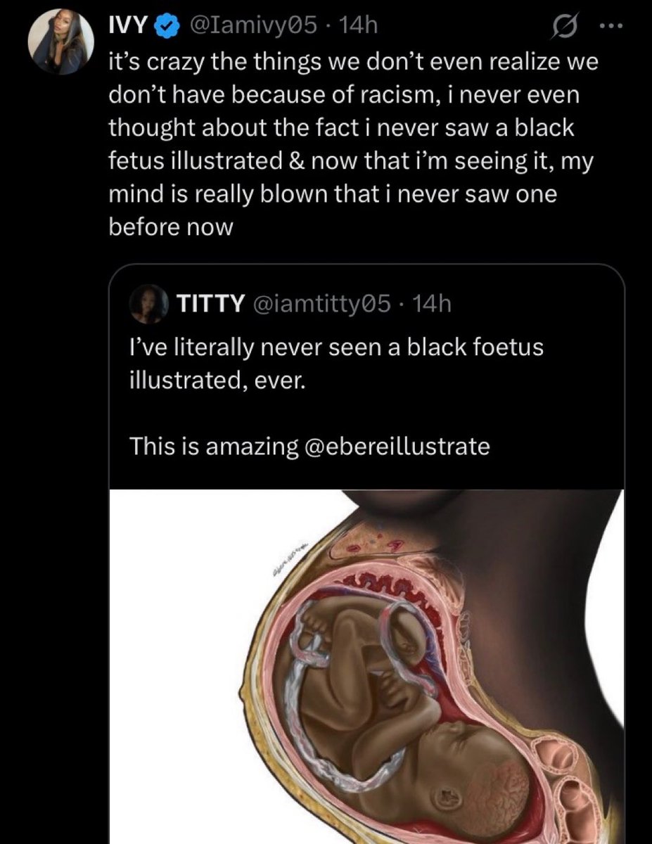 leonardaisfunE's tweet image. No one stopped black people from drawing fetuses in the womb. It’s not White people’s fault you guys are retarded.