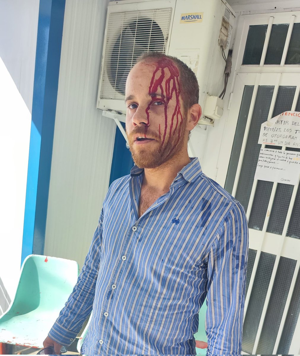 La policía de Jujuy reprime con palos y disparos al aire a obreros q intentan ingresar a una asamblea  del sindicato azucarero SOEAIL en Ledesma para expulsar a delegados q luchan contra los despidos.
Así impiden la participación  democrática de quienes no avalarían este ataque.